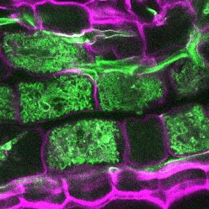 Fungal arbuscules inside plant root cells