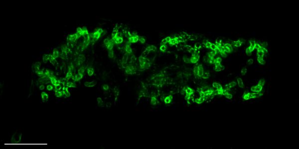 Rice-plant-colonised-the-AM-fungus-Rhizophagus-irregularis-grown-and-imaged-in-the-AMSlide.-The-arbuscule-is-surrounded-by-a-green-fluorescent-protein-scaled