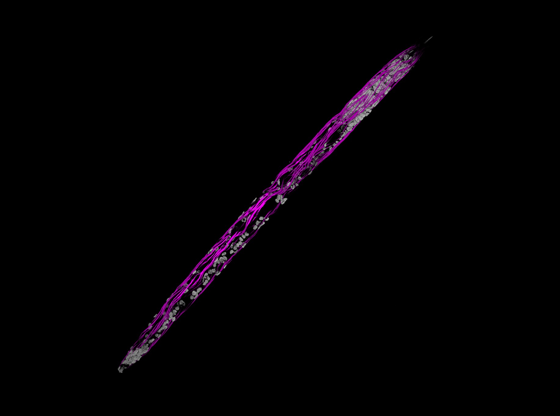 Sonawala et al. describe how the HYP genes in plant-parasitic nematodes can harbour thousands of alleles. They elucidate the ‘rules’ underlying variation in the Hyper Variable Domain (HVD) of HYPs, and propose that these data are consistent with a mechanism of somatic genome editing, termed HVD-editing. Juxtaposed to this proposed hidden genetic diversity across its body, the accompanying confocal 3D projection of DAPI- and Phalloidin-labelled pre-parasitic Heterodera schachtii visualises the heterogeneity of the internal tissues.