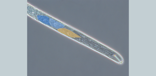 Reference: Pellegrin and Damm et al., The SUbventral-Gland Regulator (SUGR-1) of nematode virulence, Proceedings of the National Academy of Sciences (PNAS), 122, https://doi.org/10.1073/pnas.2415861122 (2025)